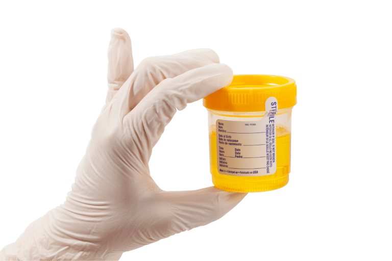 Will Ketamine Show Up On A Drug Test? Hair, Urine, & Blood Analysis Tripsitter